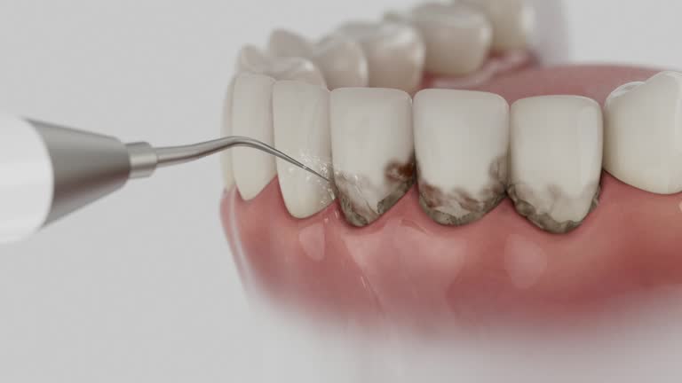 Trusted Wisdom Tooth Removal service in Patterson Tract, CA - Dentist Open Now